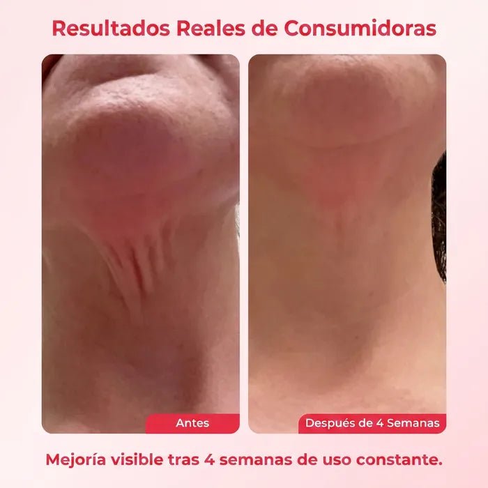 Crema Reafirmante para el Cuello Koriderm™ Time Reverse - Solvia ES