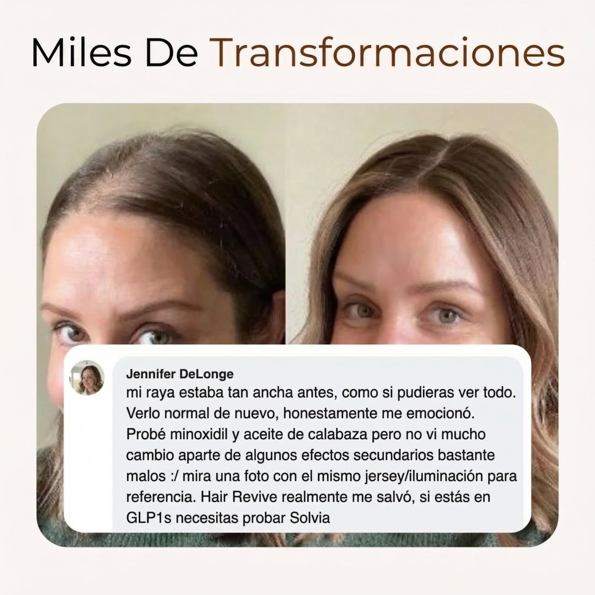 Detén la Caída de Cabello por GLP - 1 y Recupera Tu Confianza - Solvia ES