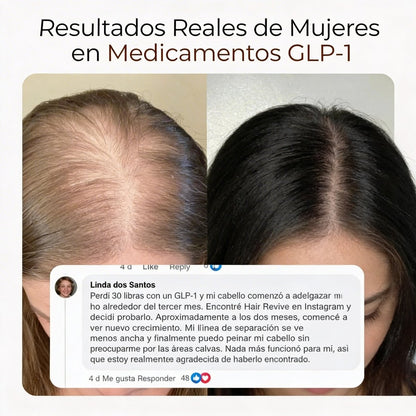 Detén la Caída de Cabello por GLP - 1 y Recupera Tu Confianza - Solvia ES