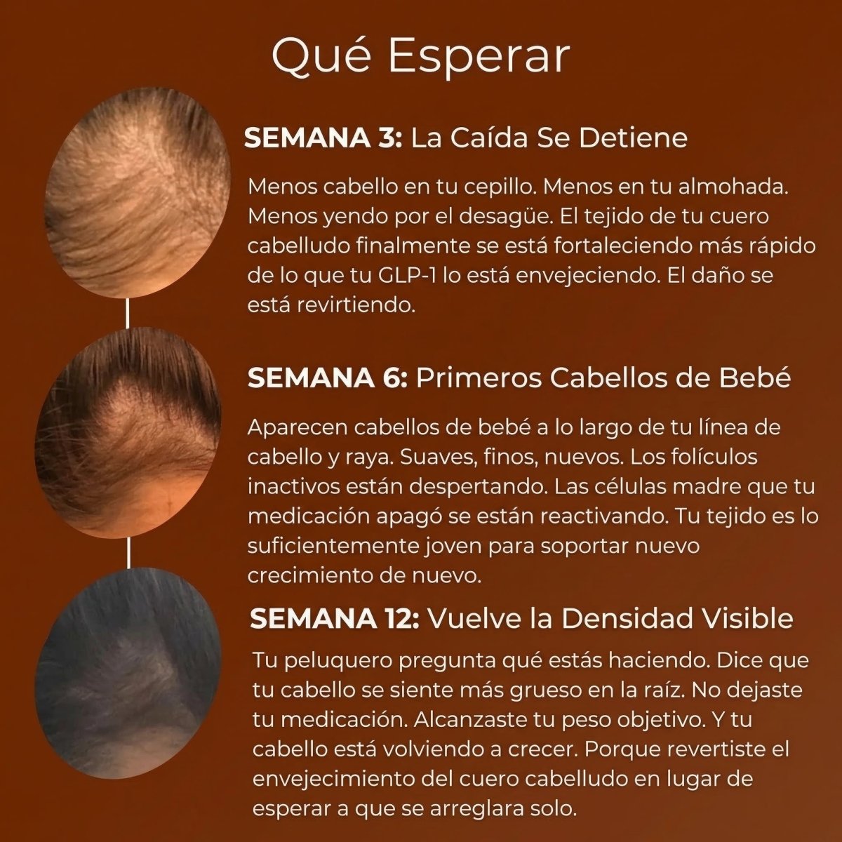 Detén la Caída de Cabello por GLP - 1 y Recupera Tu Confianza - Solvia ES