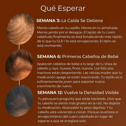 Detén la Caída de Cabello por GLP - 1 y Recupera Tu Confianza - Solvia ES