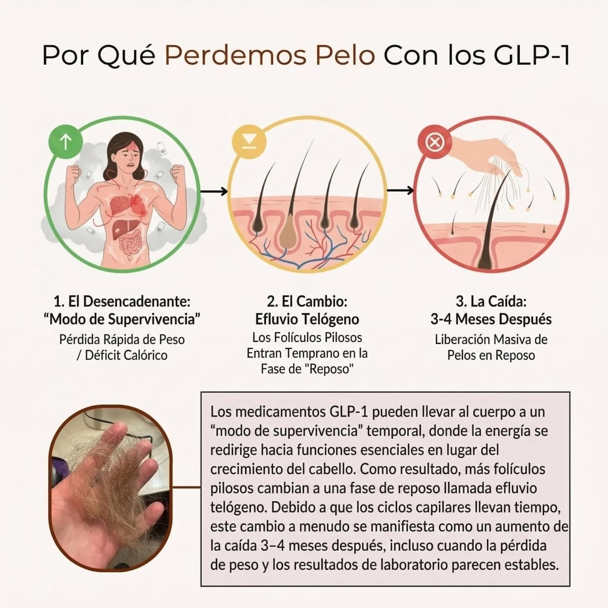 Detén la Caída de Cabello por GLP - 1 y Recupera Tu Confianza - Solvia ES