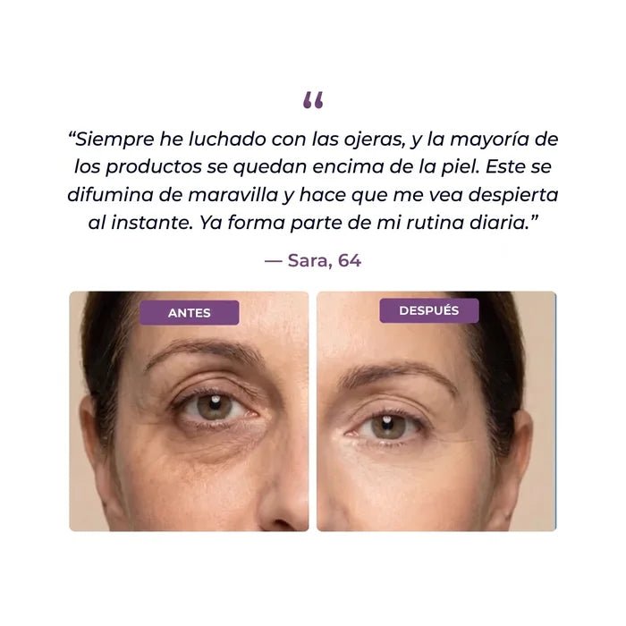 Iluminador de Ojeras EyeCorrect+ - Solvia ES