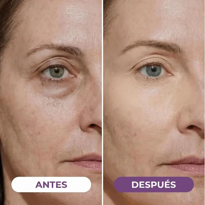 Iluminador de Ojeras EyeCorrect+ - Solvia ES