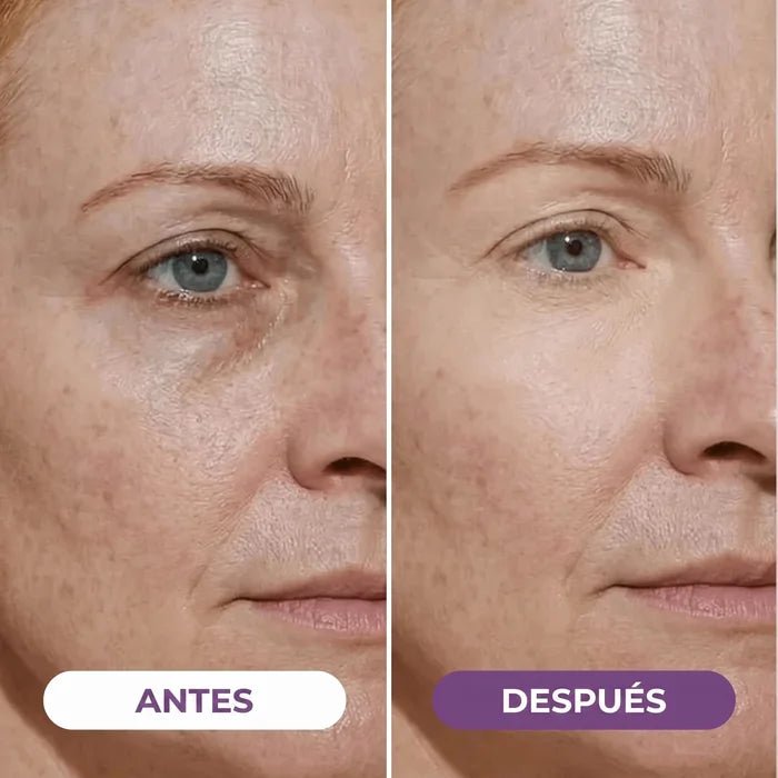 Iluminador de Ojeras EyeCorrect+ - Solvia ES