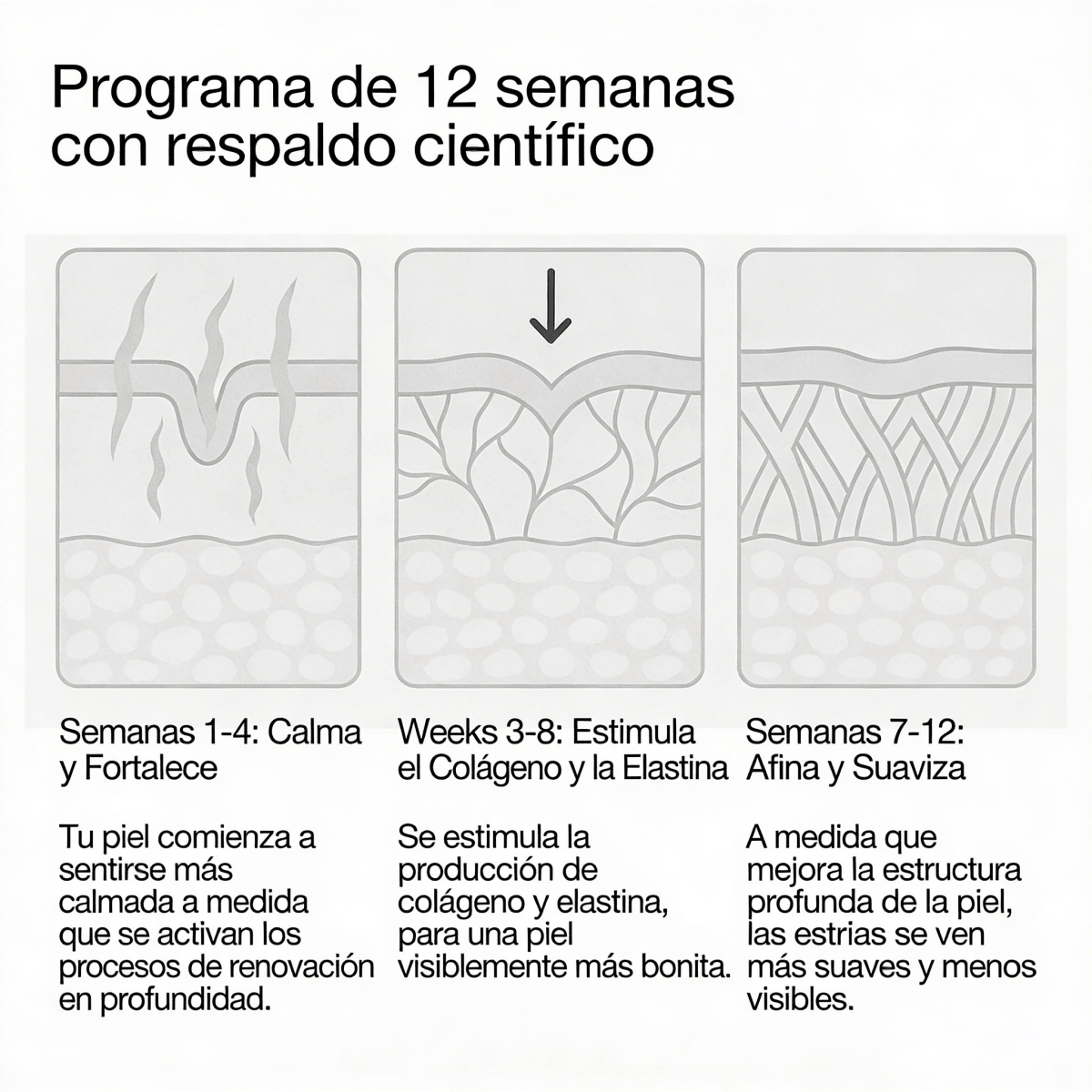 Redefiniendo la crema para estrías - Solvia ES
