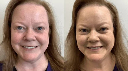 Solvia Sérum Anti - Rojeces - Solvia ES
