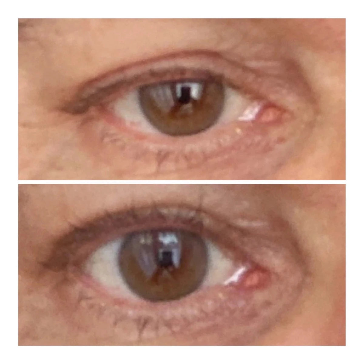 VARITA LIFTING DE OJOS - Solvia ES