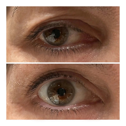 VARITA LIFTING DE OJOS - Solvia ES
