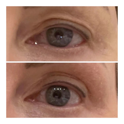 VARITA LIFTING DE OJOS - Solvia ES